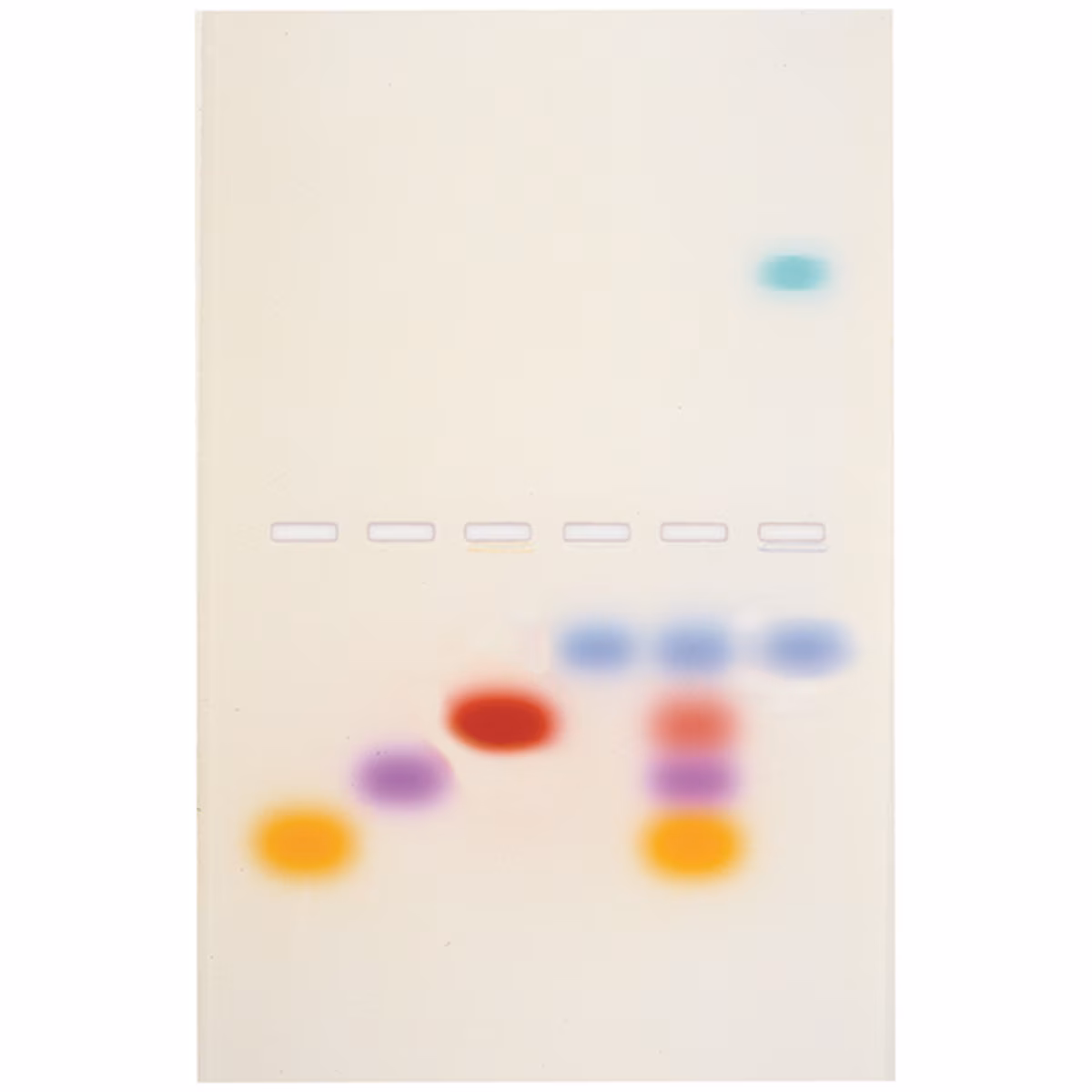 Principles and Practice of Agarose Gel Electrophoresis