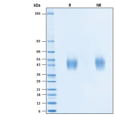 Recombinant Human IL-7 Protein (His-tag) (500 µg)