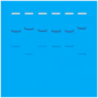 DNA Fingerprinting by Restriction Enzyme Patterns