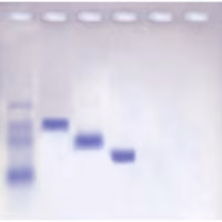 Molecular Weight Determination of Proteins (Agarose-based)