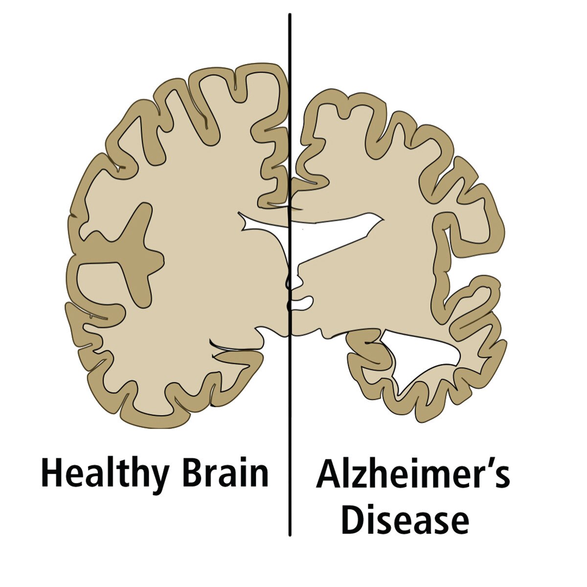 Researching Alzheimer's Disease by ELISA