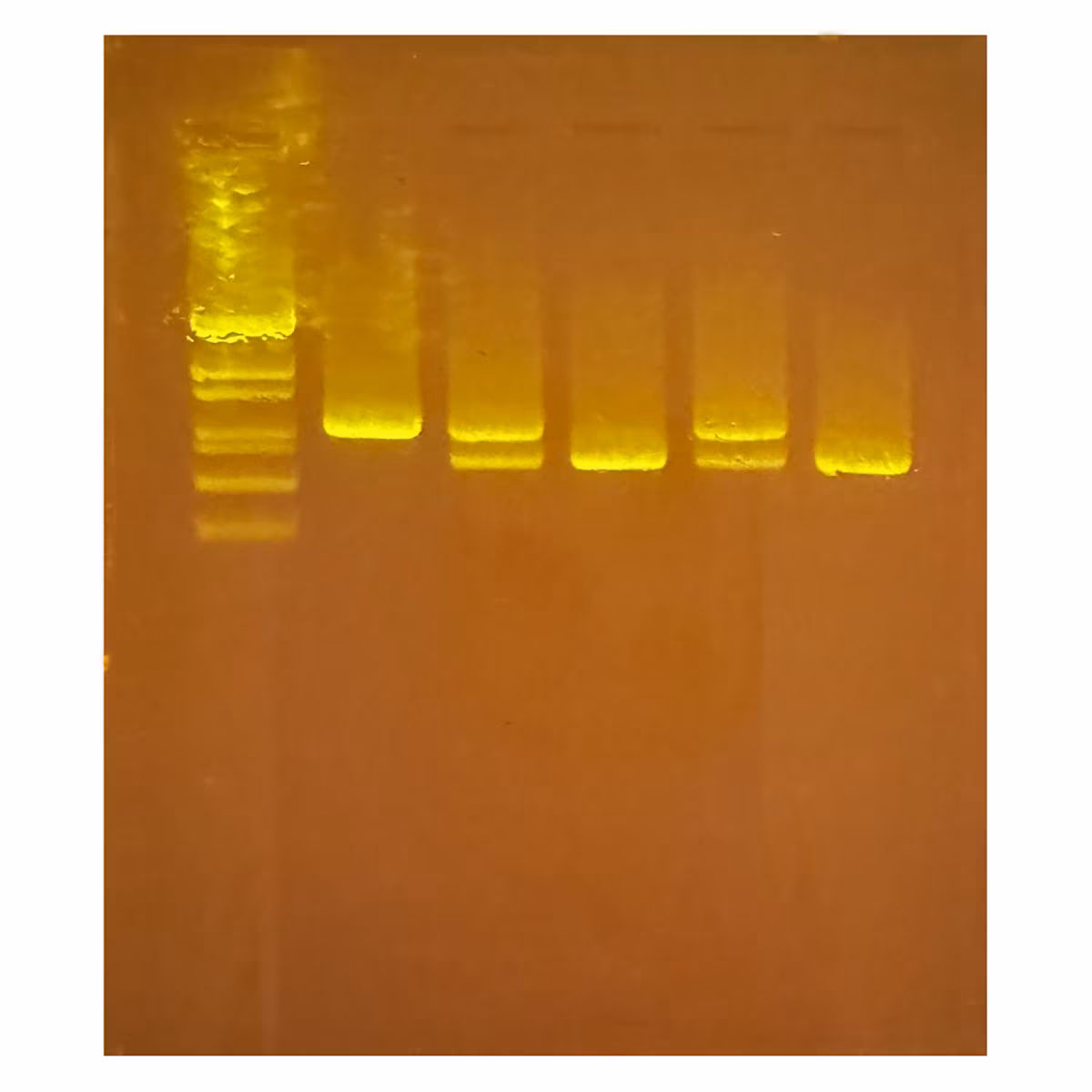 Diagnosing Huntington's Using PCR