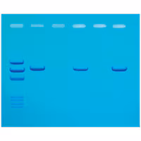 Detection of Mad Cow Disease