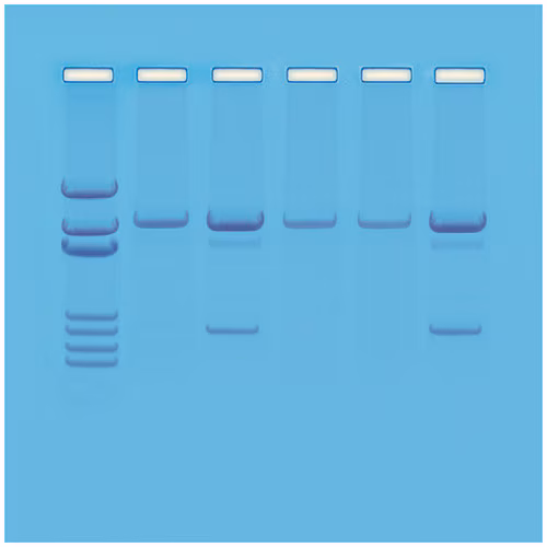 Detection of Genetically Modified Organisms