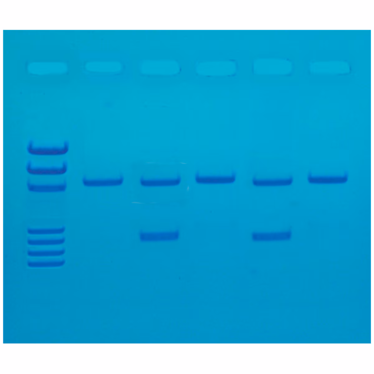 Detection of the Influenza Virus