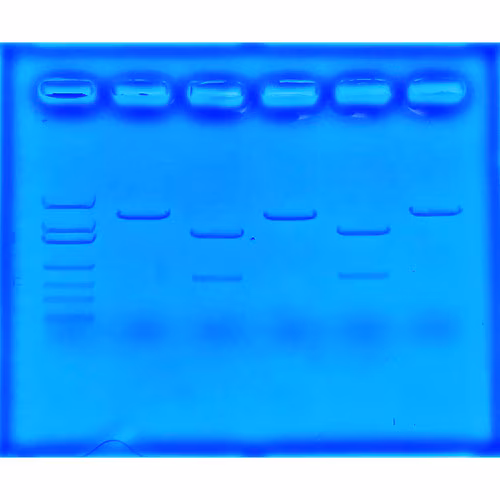 Using CRISPR To Treat Cystic Fibrosis