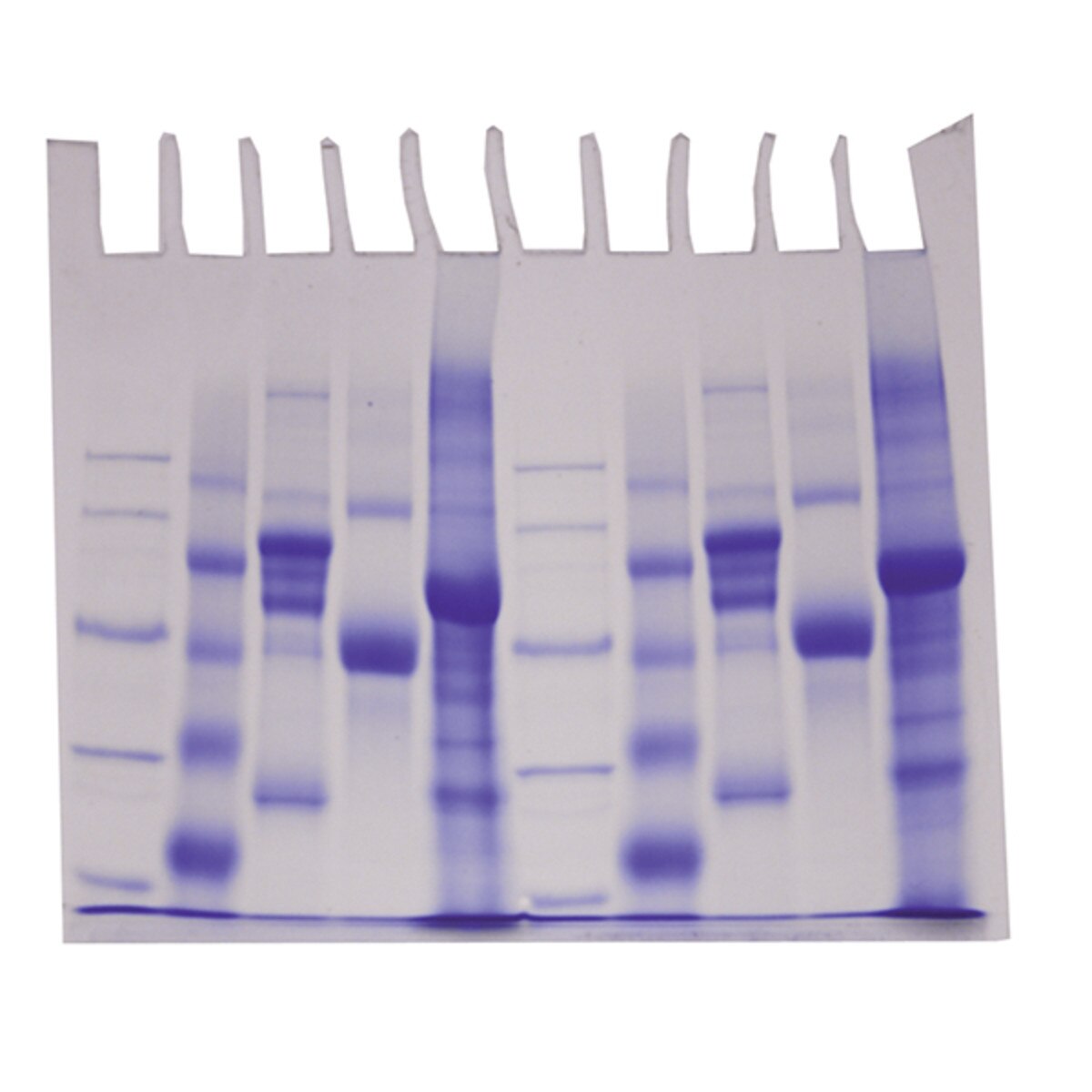 Survey of Protein Diversity