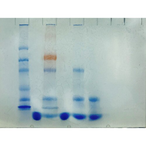 AIDS Kit III: Simulation of HIV Detection by Protein Electrophoresis
