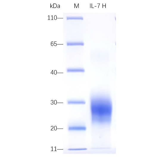 Recombinant Human IL-7 Protein (His-tag) (100 µg)