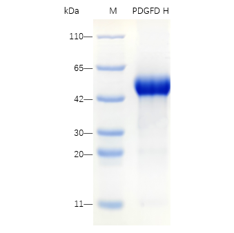 Recombinant Human VEGF165 Protein (His-tag) (10 µg)