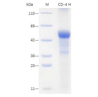 Recombinant Mouse CD4 Protein (His-tag) (100 µg)