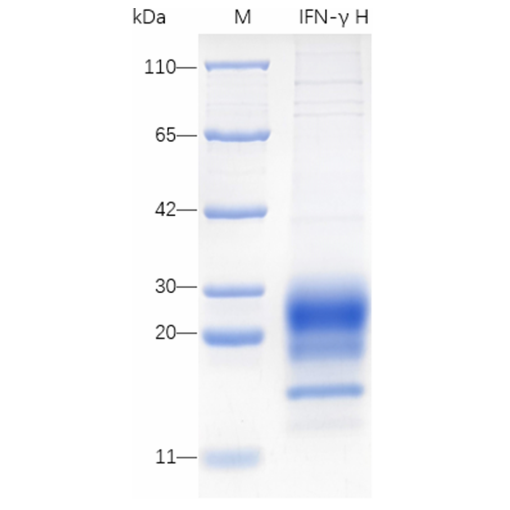 Recombinant Mouse IFN-gamma Protein (His-tag) (100 µg)