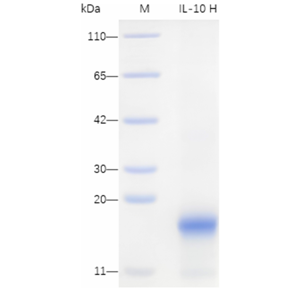 Recombinant Human IL-10 Protein (His-tag) (10 µg)