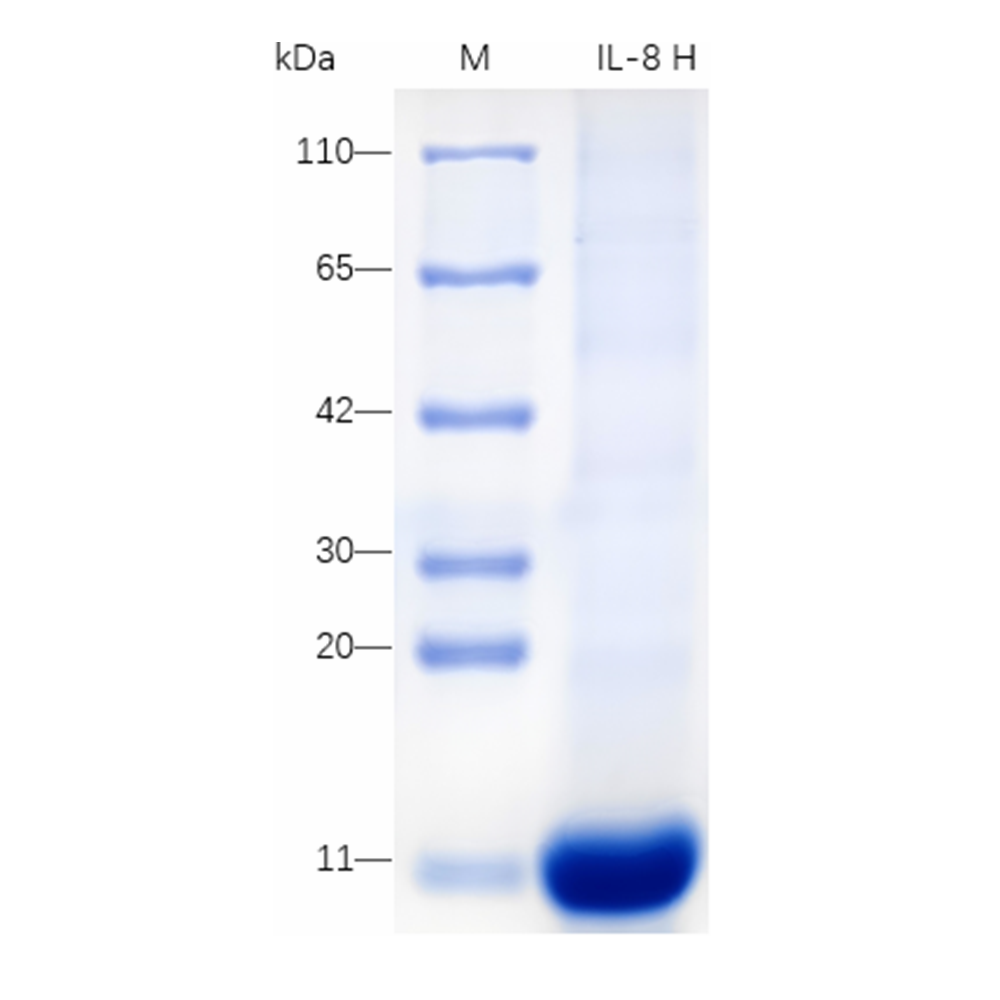 Recombinant Human IL-8 Protein (His-tag) (10 µg)