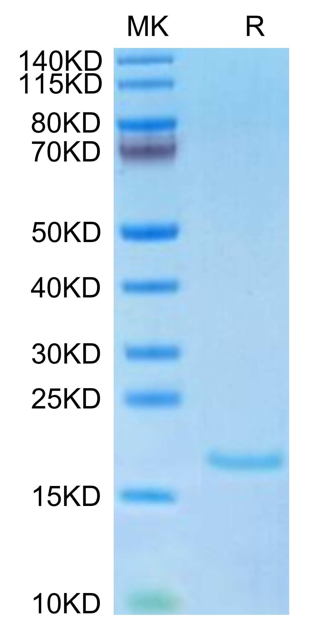 Recombinant Human IL-1 alpha Protein (His-tag) (10 µg)
