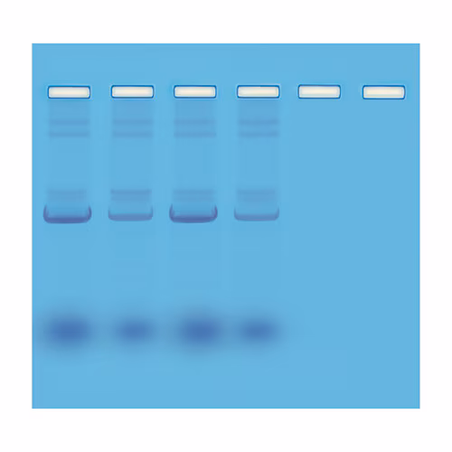 Mini-Prep Isolation of Plasmid DNA