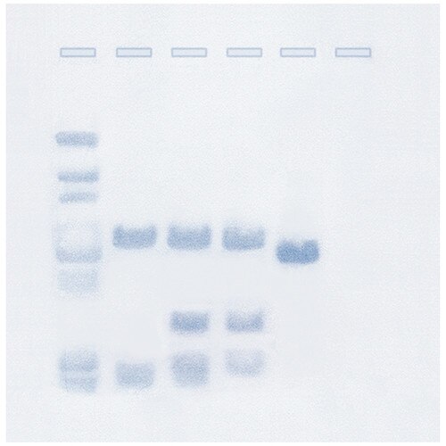 Southern Blot Analysis