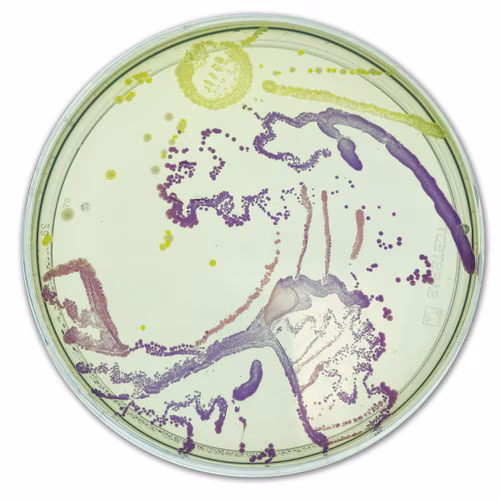 Agar Art: Creating Masterpieces with Microbes