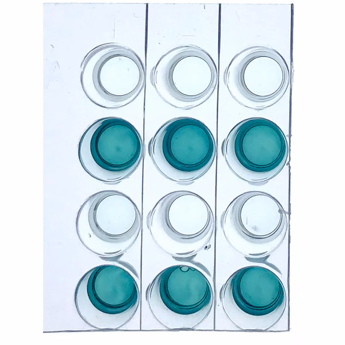 Investigating Human Health Using the ELISA