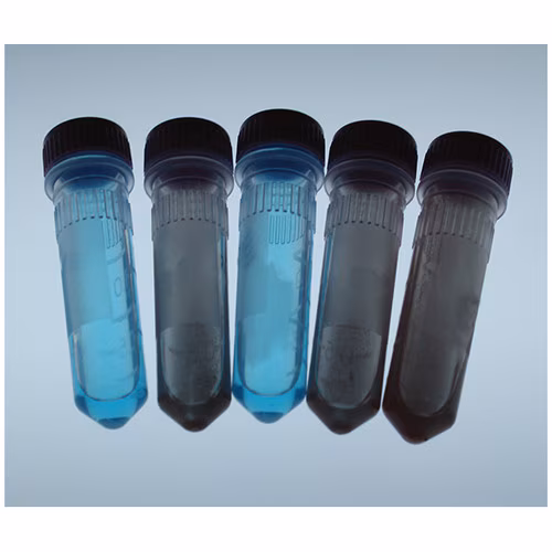 Detecting the Silent Killer: Clinical Diagnosis of Diabetes