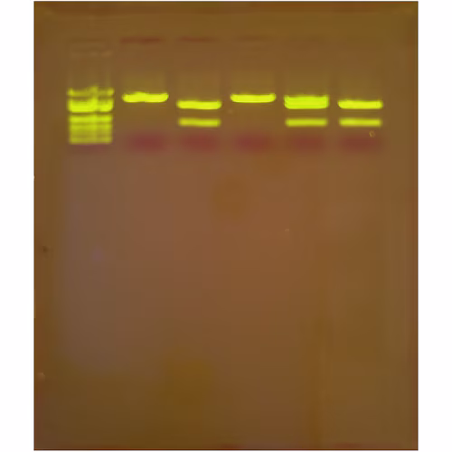 In Search of the Cholesterol Gene