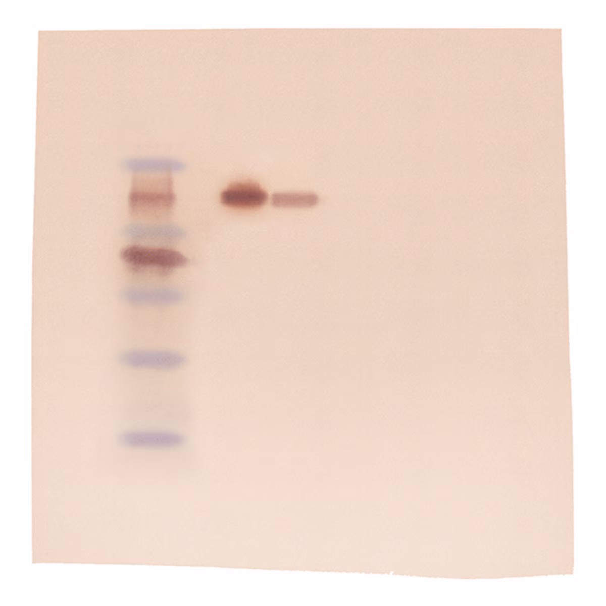 Western Blot Analysis (Polyacrylamide-based)