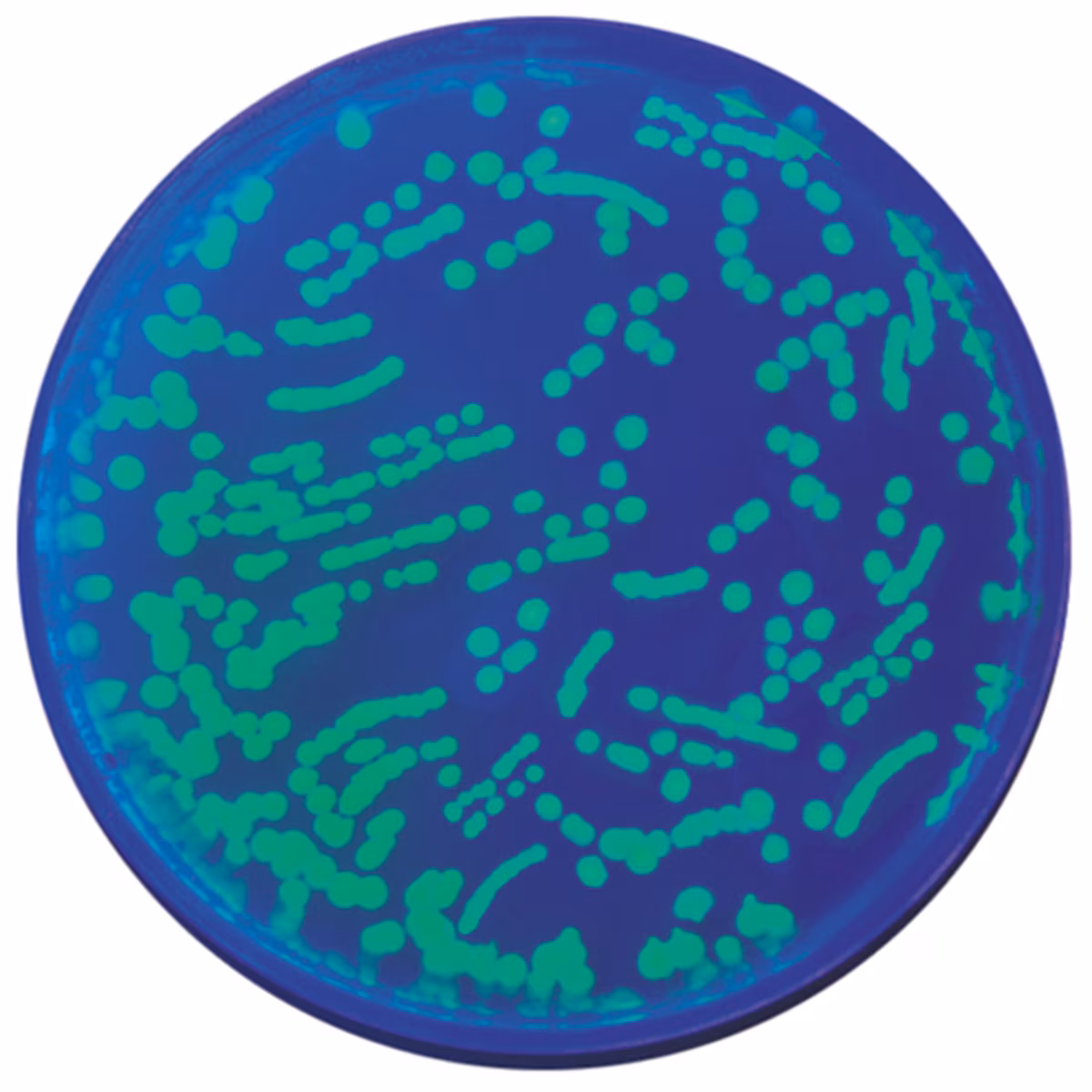 GFP Transformation Extension: Colony PCR