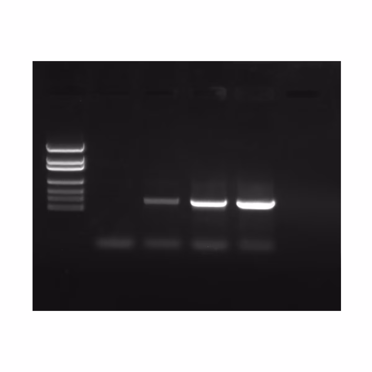 PCR Amplification of DNA