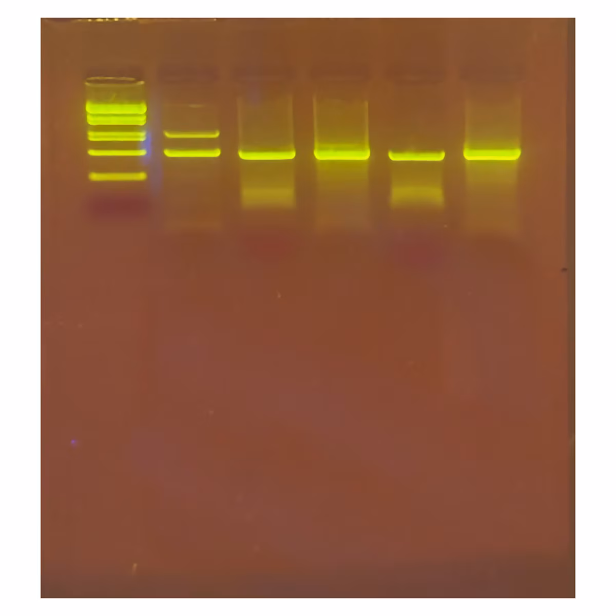 Alu Human DNA Typing Using PCR