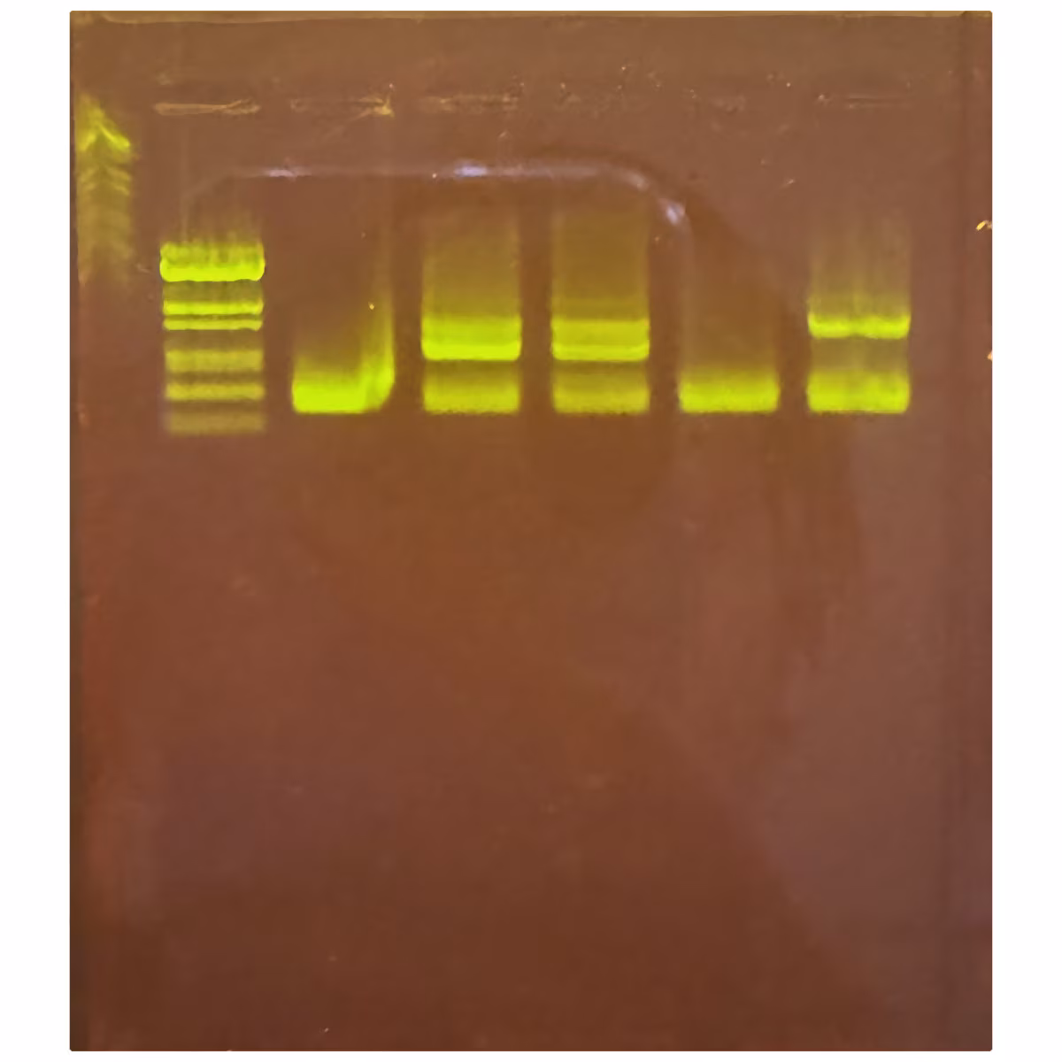 Detecting COVID-19 Using Reverse-Transcription PCR (RT-PCR)