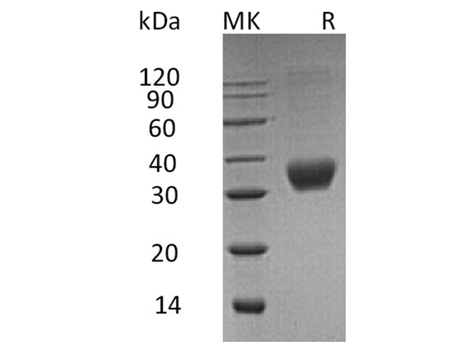 Recombinant Human FAS (CD95) Protein (His-tag) (100 µg)