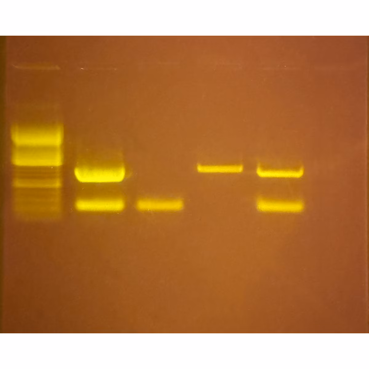 Silent Signals: Tracking Disease Through PCR Wastewater Testing