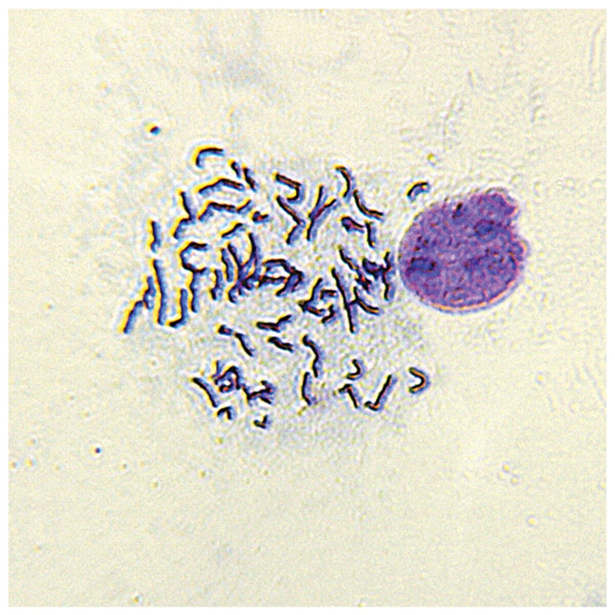 Chromosome Spread (Pre-Fixed Slides)