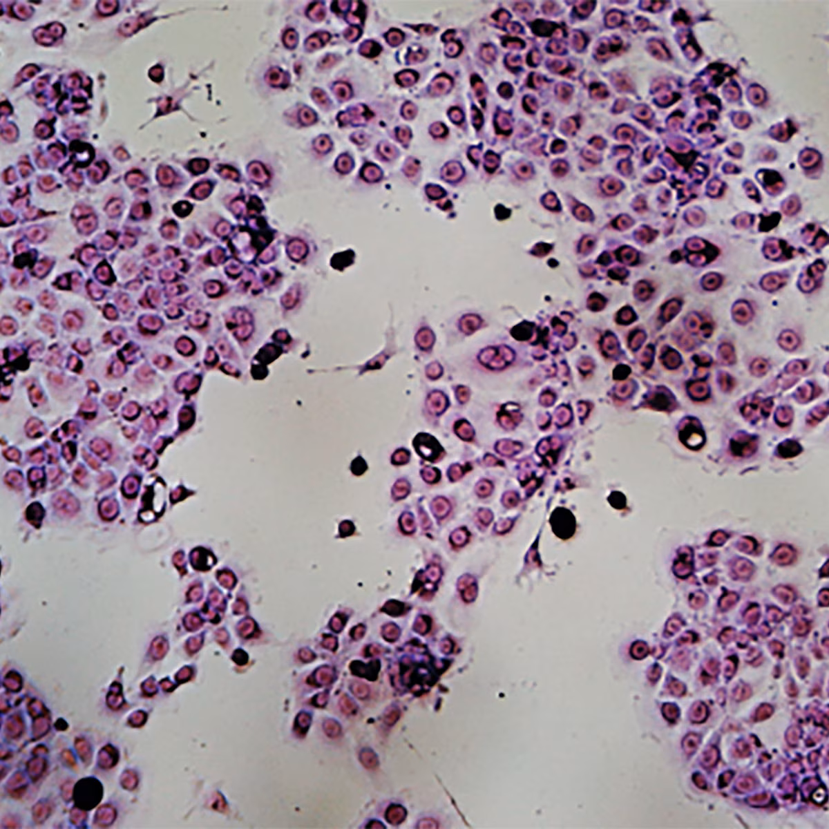 Morphology of Cancer Cells