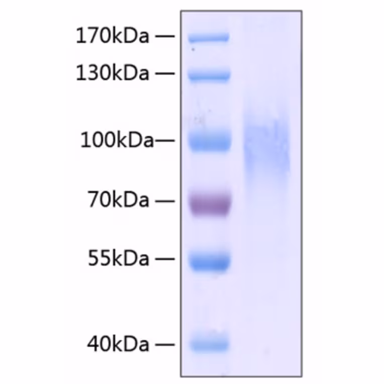 Recombinant Mouse CD68 Protein (His-tag) (10 µg)