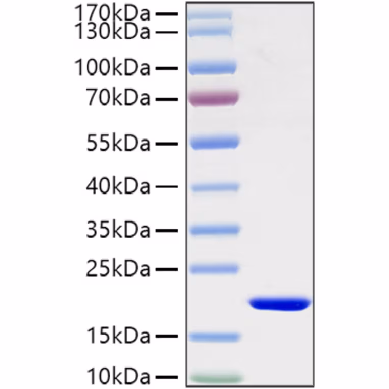 Recombinant Mouse IL-1 beta Protein (His-tag) (100 µg)