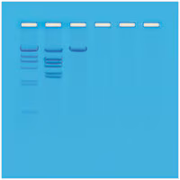 Restriction Enzyme Analysis of DNA