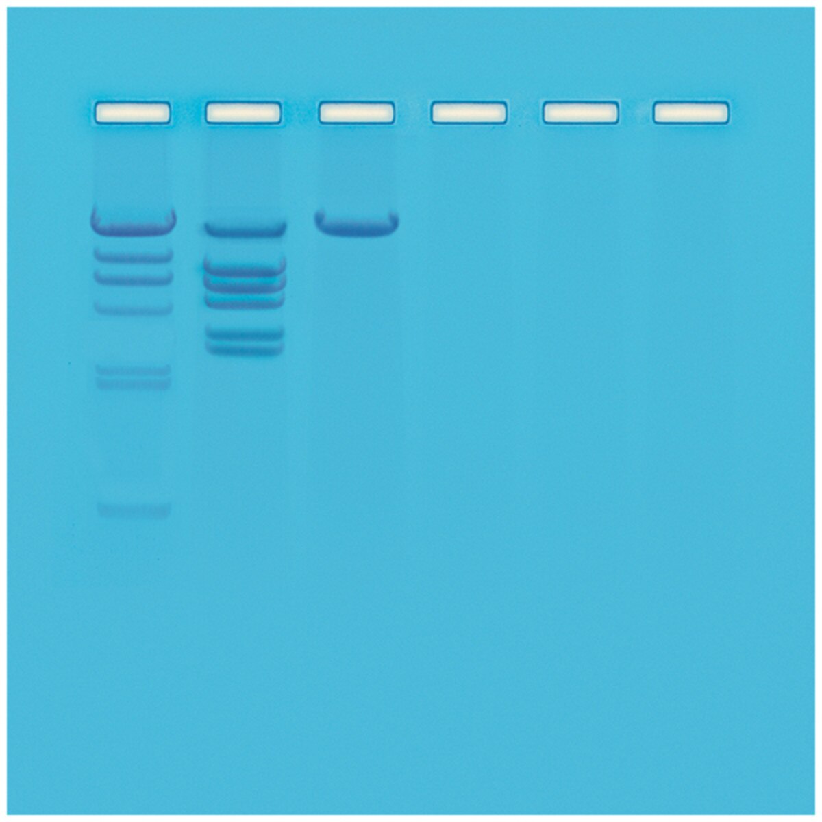 Investigation 9: Biotechnology - Restriction Enzyme Analysis of DNA