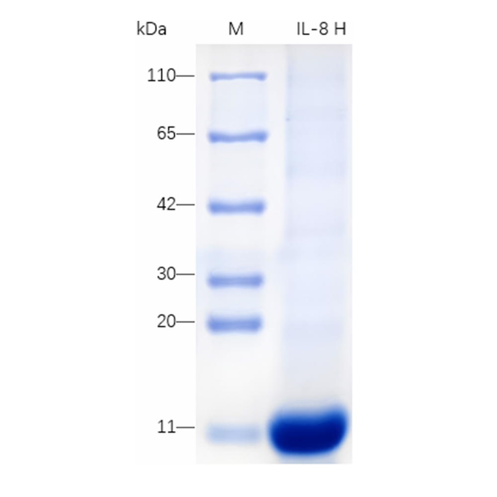 Recombinant Human IL-8 Protein (His-tag) (100 µg)
