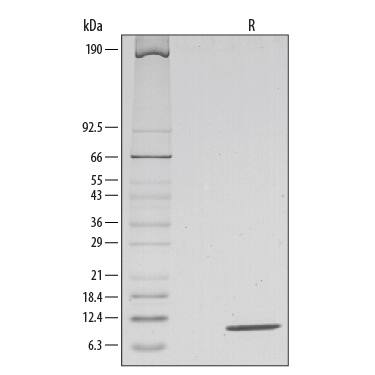Recombinant Mouse IL-13 Protein (His-tag) (10 µg)