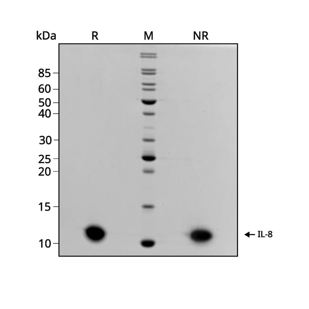 Recombinant Human IL-8 Protein (His-tag) (500 µg)