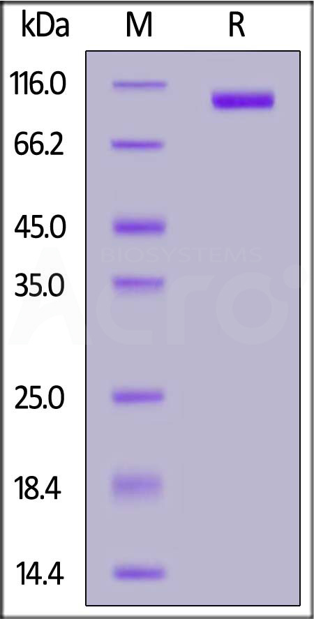 Recombinant Human IGF1R (CD221) Protein (His-tag) (500 µg)