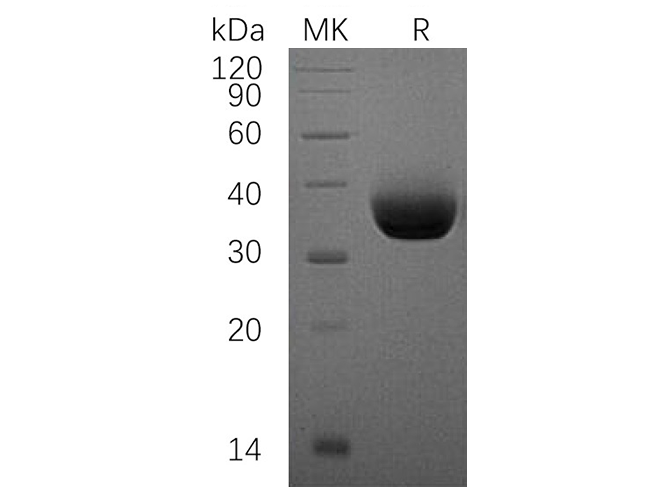 Recombinant Human PD-1 (CD279) Protein (His-tag) (10 µg