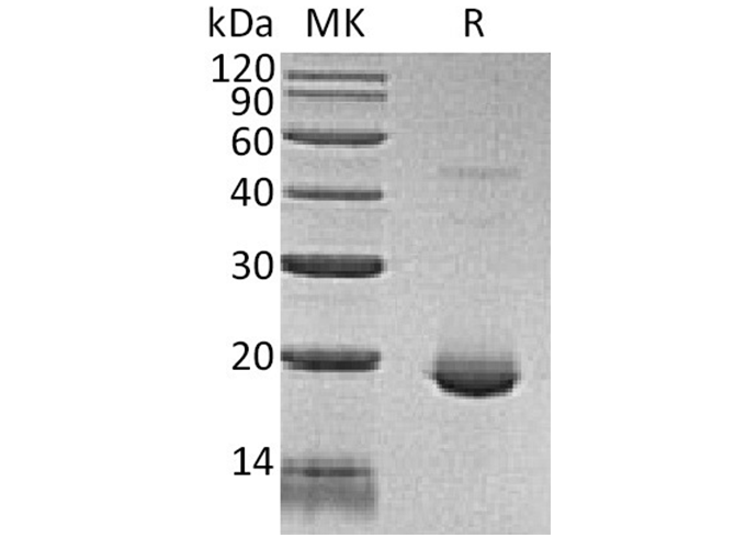 Recombinant Human IL-6 Protein (His-tag) (10 µg)