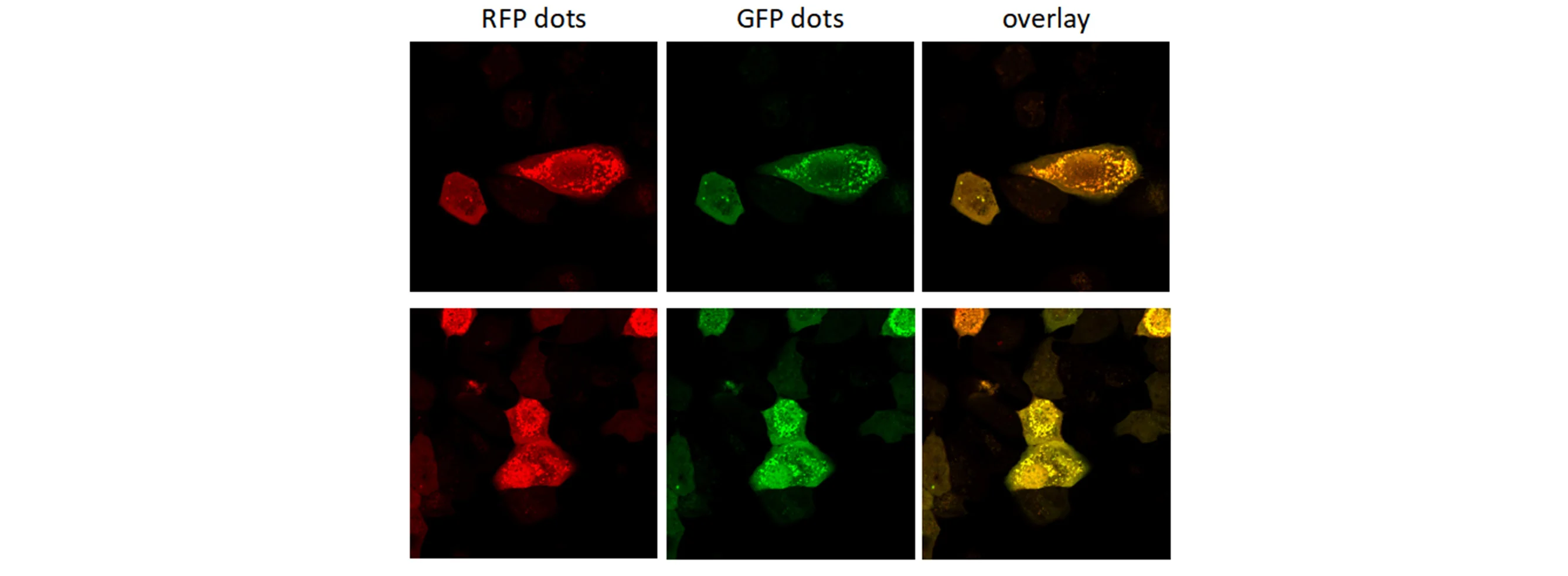 Autophagic Single-label Lentivirus EGFP-LC3B (500 µL)