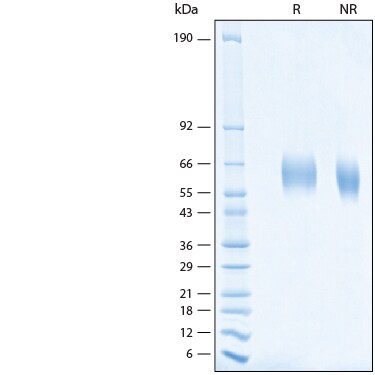 Recombinant Human IL-1 beta Protein (His-tag) (500 µg)