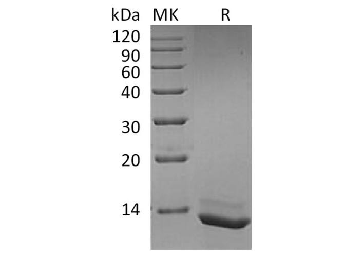 Recombinant Mouse IL-5 Protein (His-tag) (500 µg)