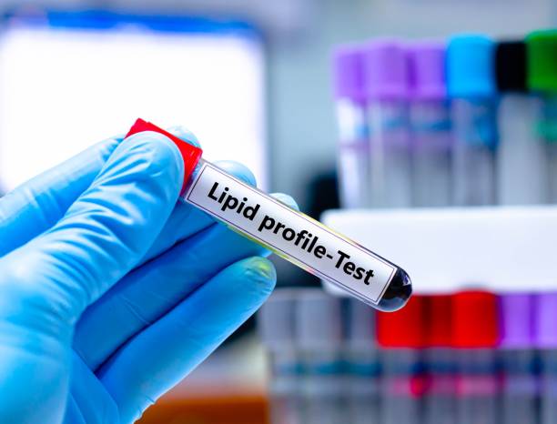 Lipid Profile Tests