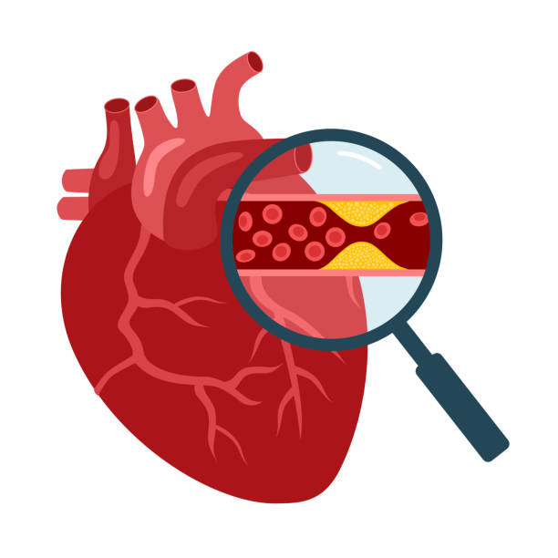 Creatine Kinase Isoenzyme-MB