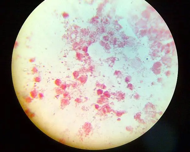 Gram Stain